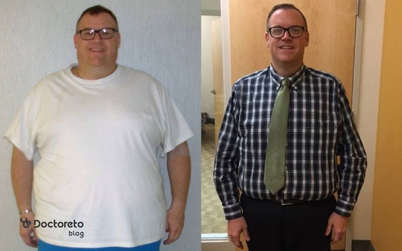 تجربیات کسانی که عمل اسلیو معده انجام داده اند