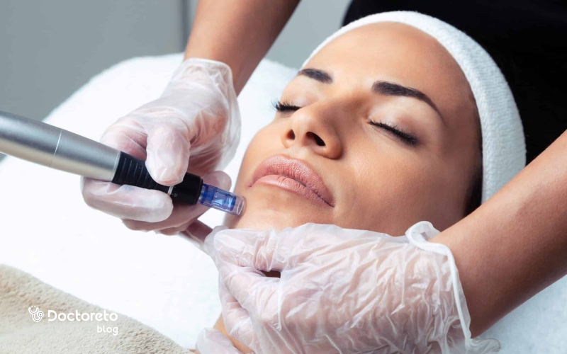 میکرونیدلینگ خانگی چگونه است؟