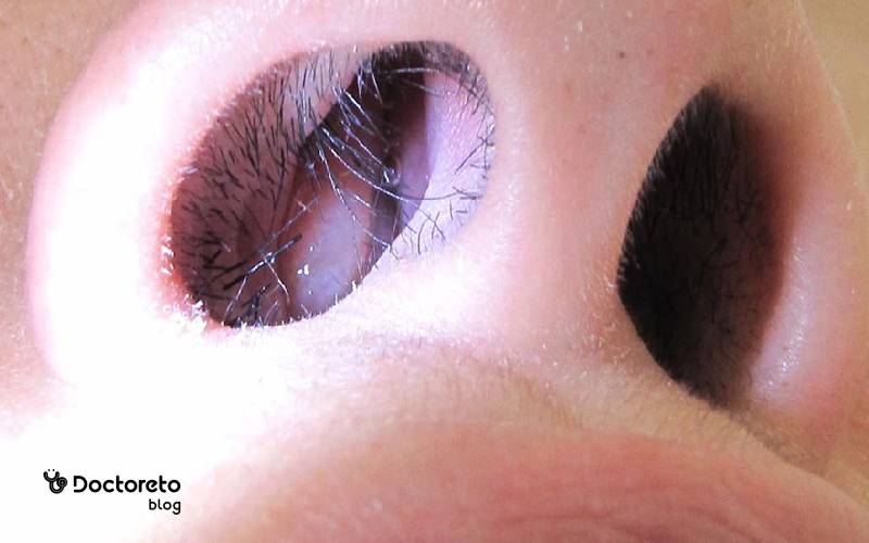 درمان پولیپ بینی با پیاز ممکن است؟