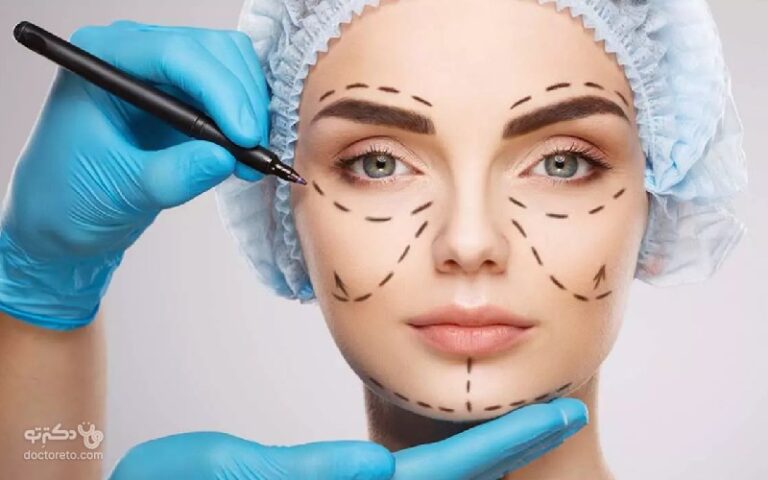 پروتز گونه چیست؟ بهترین روش برجسته کردن گونه و عوارض آن