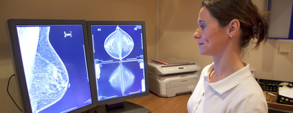 mammography-result