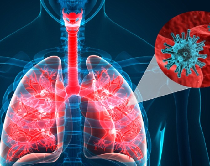 cytokine-release-syndrome-in-covid19