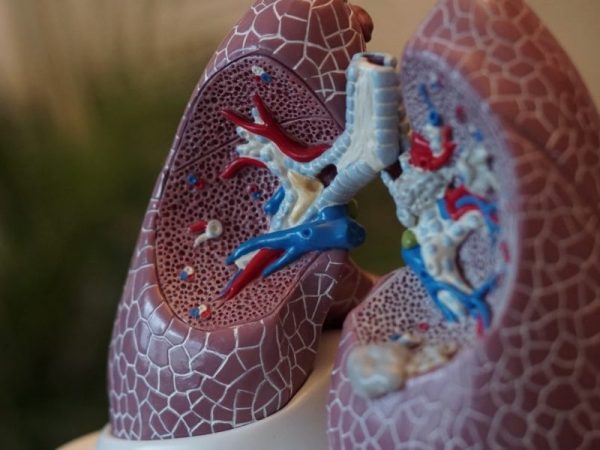 Pulmonary-embolism
