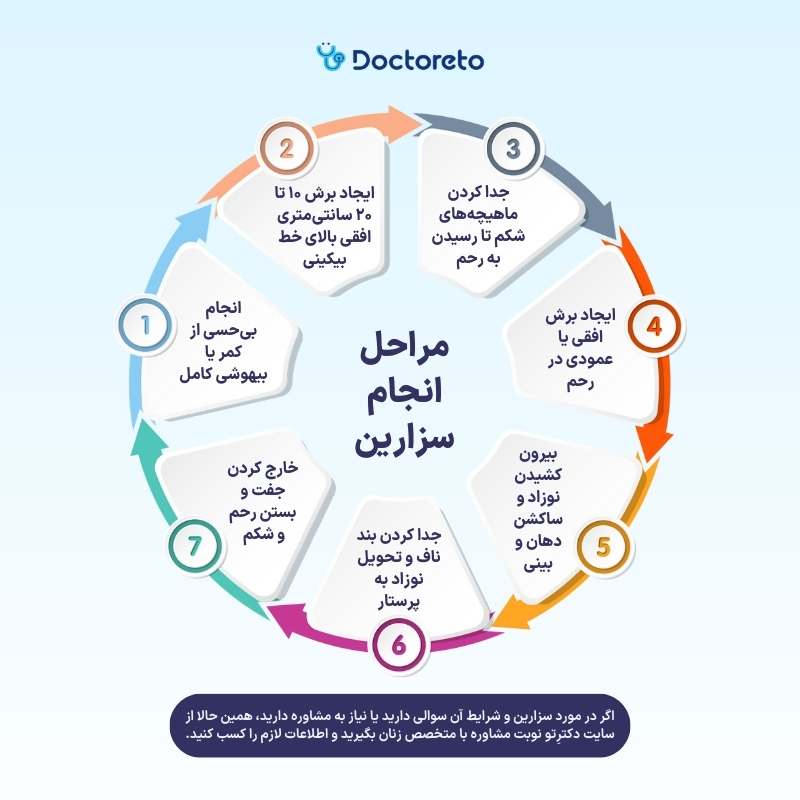 اسنفوگرافی زایمان سزارین