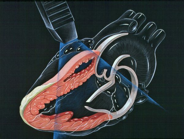 echocardiography