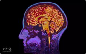 ام ار ای (MRI) چیست و چه کاربردی دارد؟