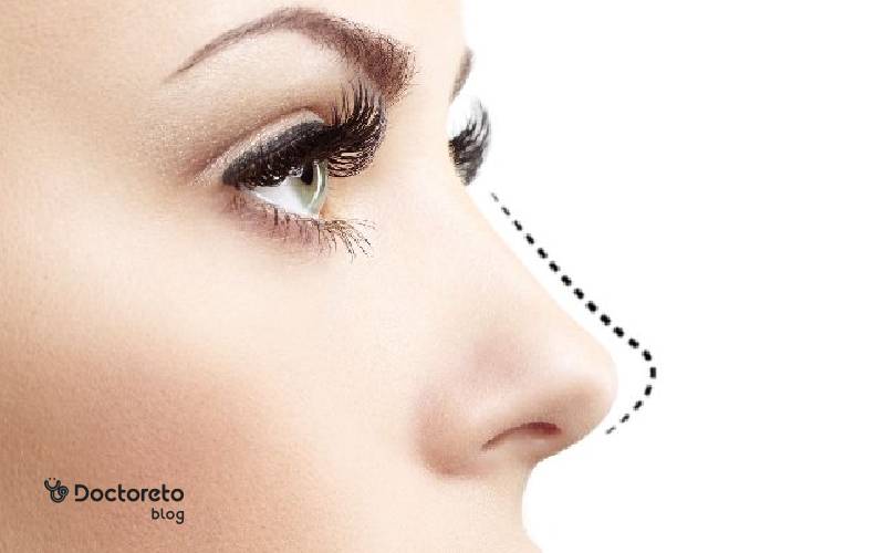 عمل زیبایی بینی های گوشتی و جراحی زیبایی بینی های غضروفی