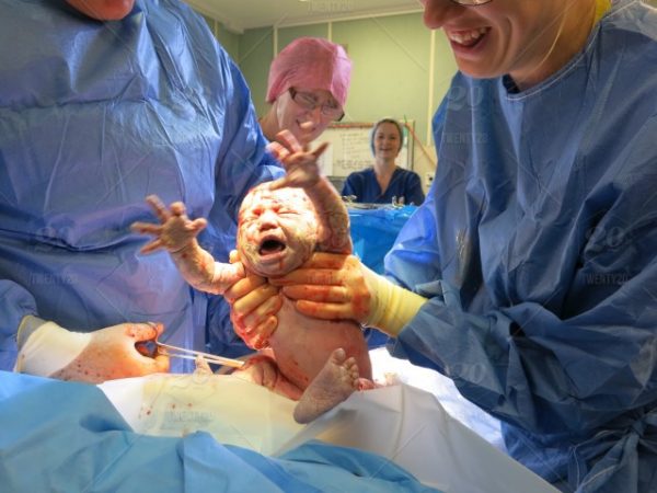 natural-birth-giving-after-c-section