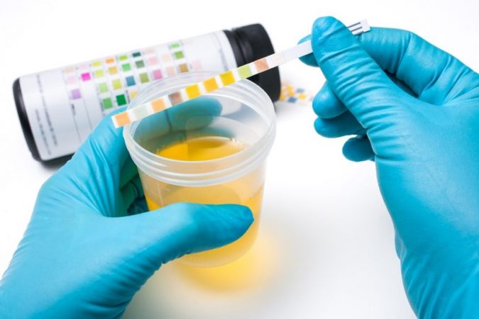 urine-drug-test