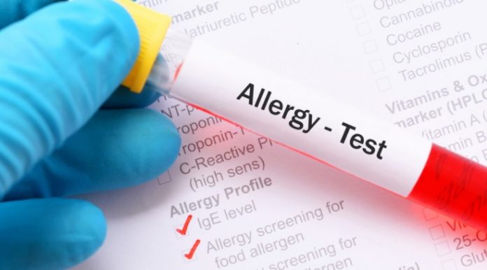 تست آلرژی یا حساسیت چیست؟