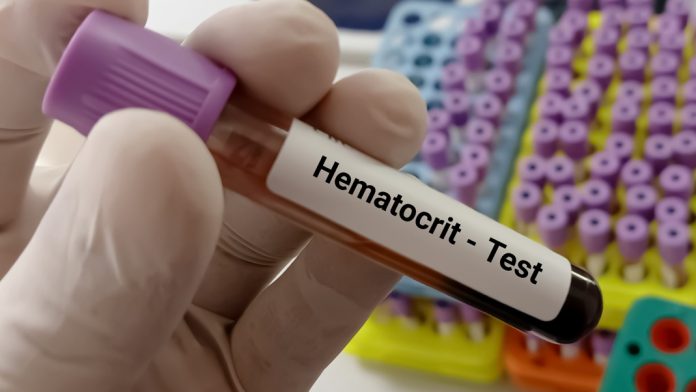 hematocrit-test