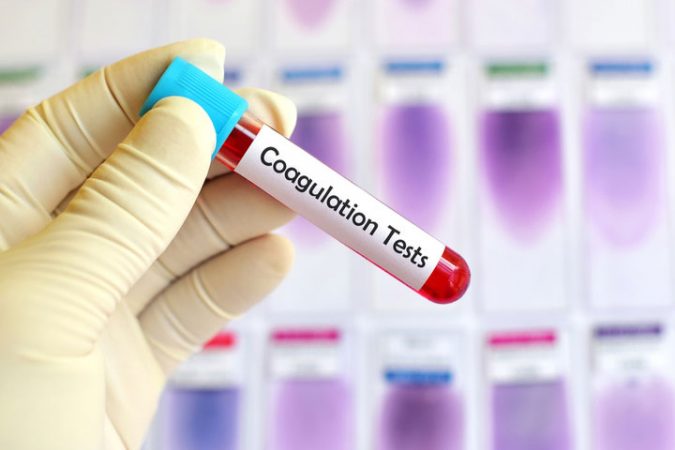 coagulation-tests