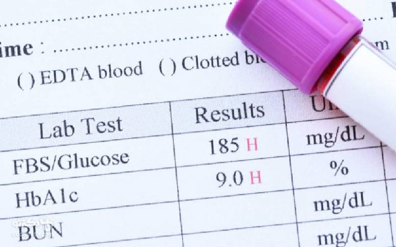 آزمایش قند خون (FBS)؛ راهنمای خواندن برگه آزمایش و تفسیر نتیجه آن