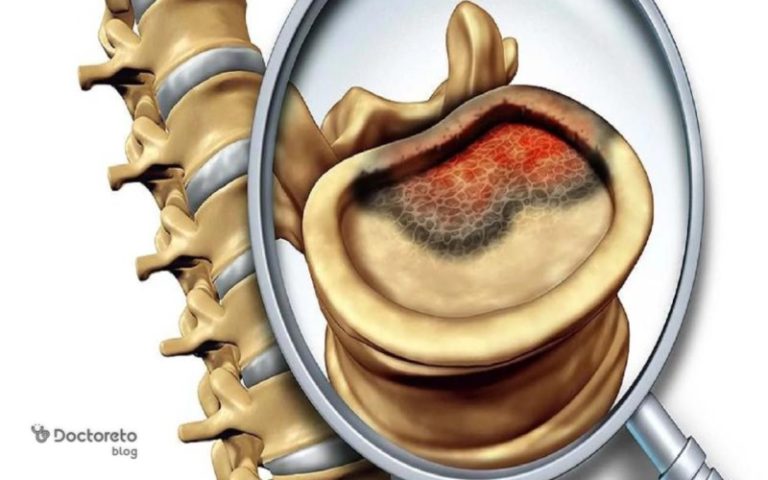 هر آنچه باید درباره سرطان مغز استخوان بدانید