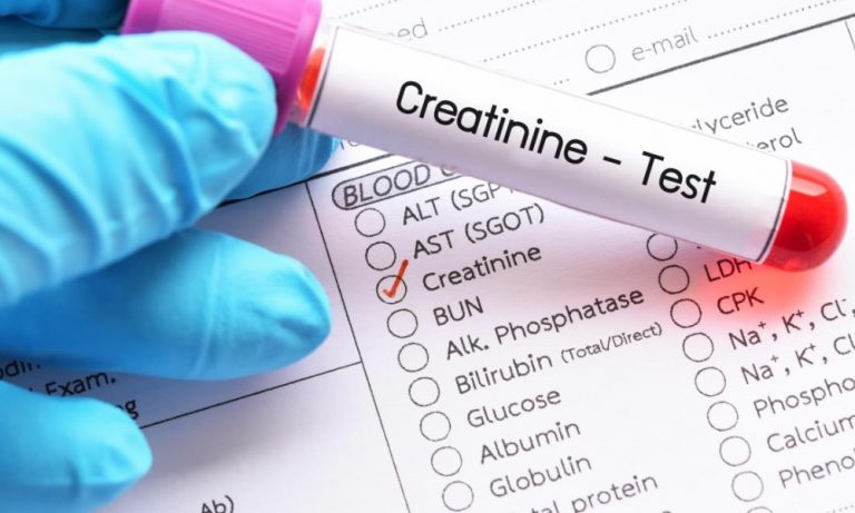 creatinine-blood-test