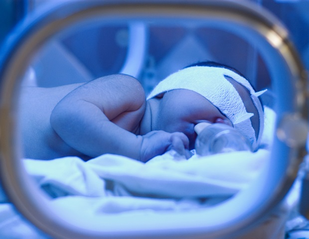 neonatal-jaundice neonatal-jaundice