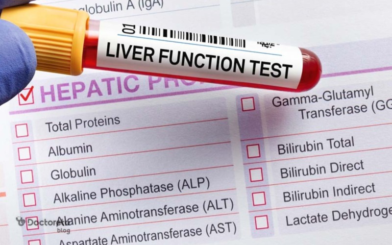 آزمایش عملکرد کبد؛ راهنمای خواندن برگه آزمایش و تفسیر آن