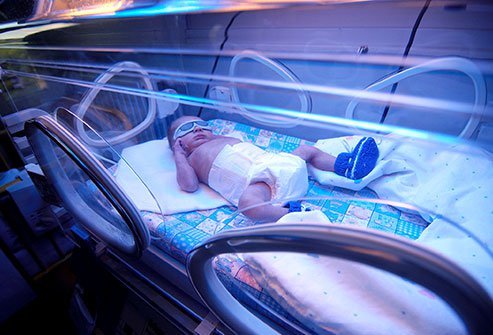 phototherapy-for-jaundice