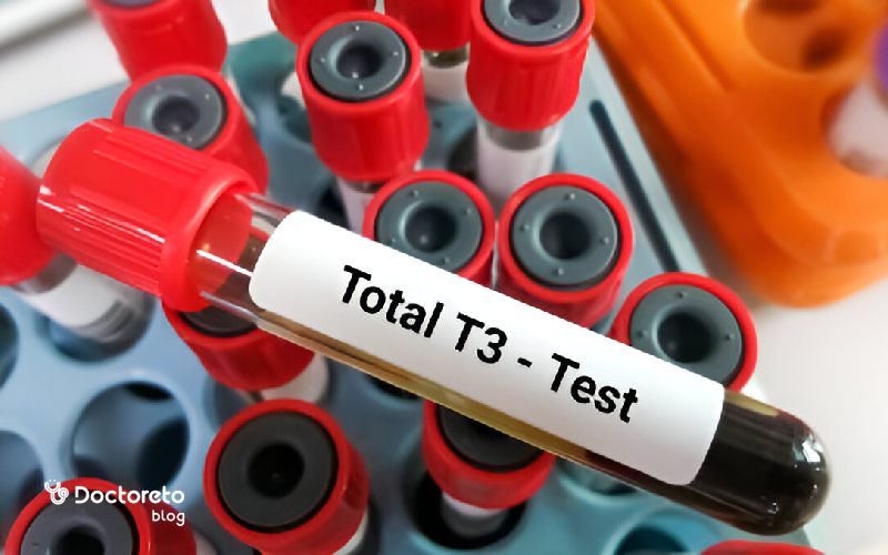 free t3 در آزمایش خون چیست؟
