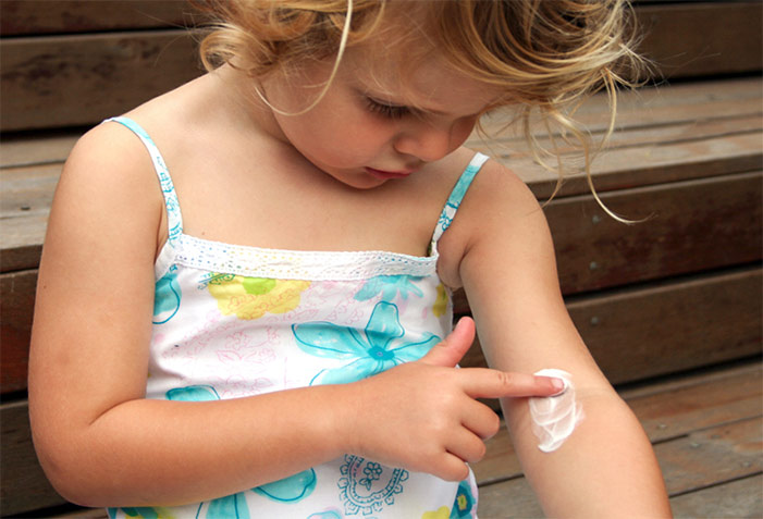 حساسیت پوستی کودکان در تابستان