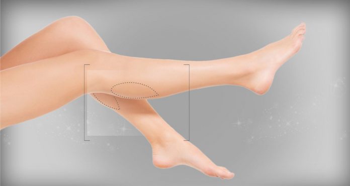 gel-injections-to-legs-and-ankles