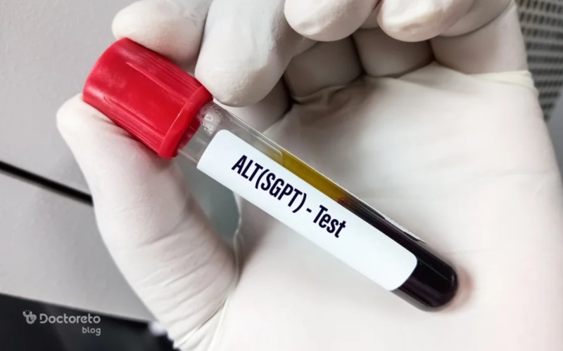 آزمایش ALT یا SGPT خون چیست؟