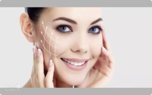 لیفت گونه چیست؟ چند نوع روش برای لیفتینگ گونه وجود دارد؟