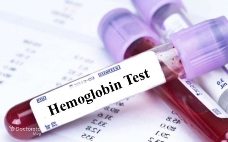 آزمایش هموگلوبین خون چیست؟