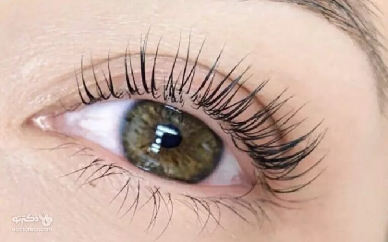 لمینت مژه: کاربرد و روش انجام آن