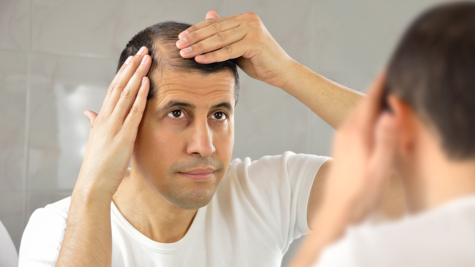 درمان-ریزش-مو-در-مردان