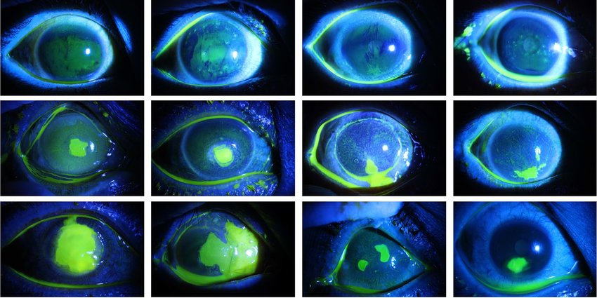 Corneal-ulcers
