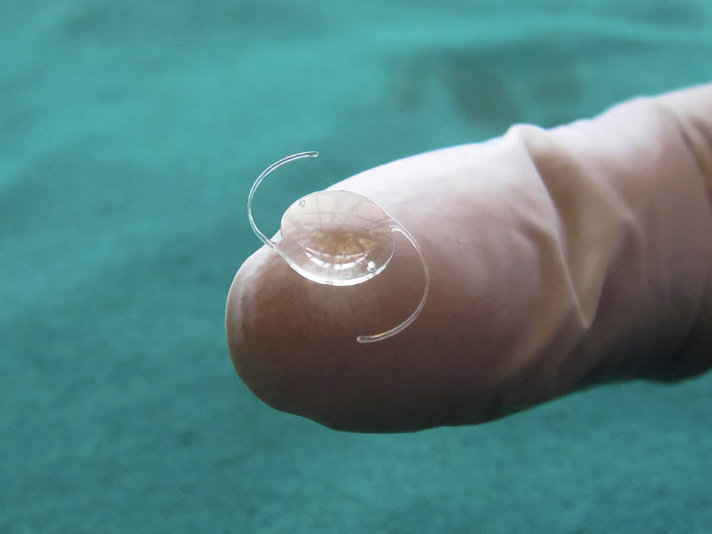 iol implants vs contact lens