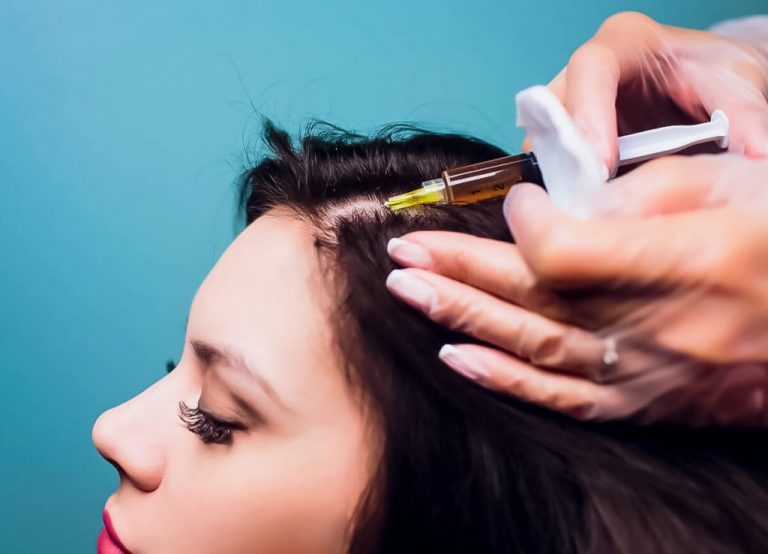 hair loss treatments in women