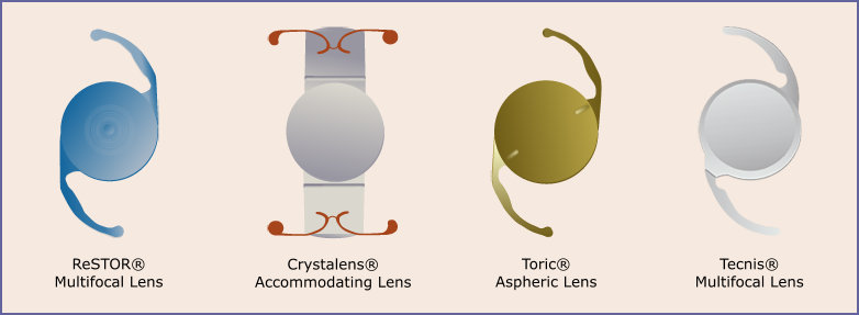 types of Intraocular Lens Implants