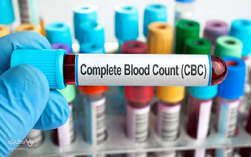 آزمایش خون (cbc)؛ راهنمای خواندن برگه آزمایش و تحلیل نتیجه آن