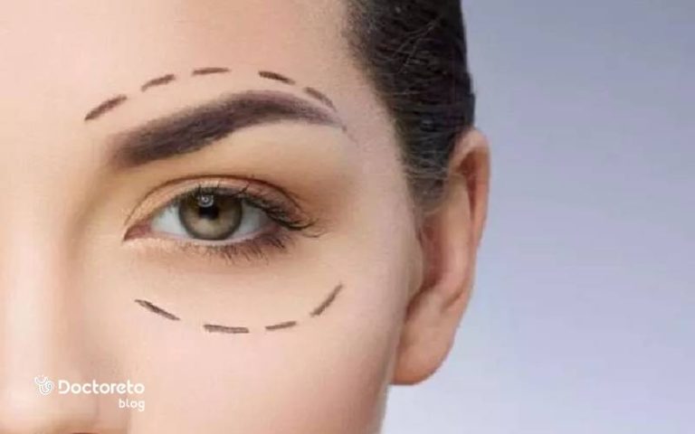 عمل زیبایی چشم، راه حلی دائمی برای داشتن چشمانی جذاب