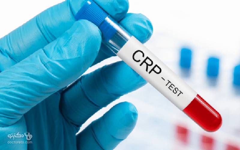 آزمایش پروتئین فعال C یا CRP و ارتباط آن با کرونا
