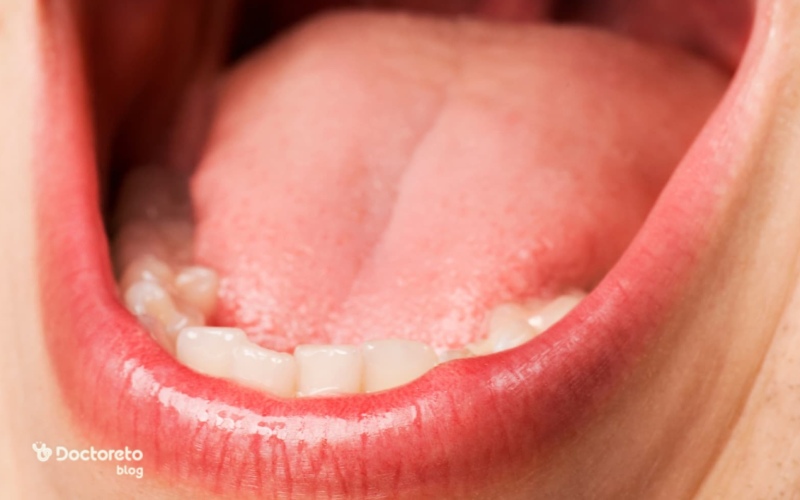 برای خشکی دهان چی خوب است؟