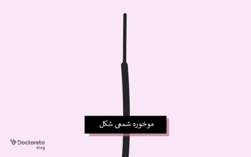 موخوره شمعی چیست؟