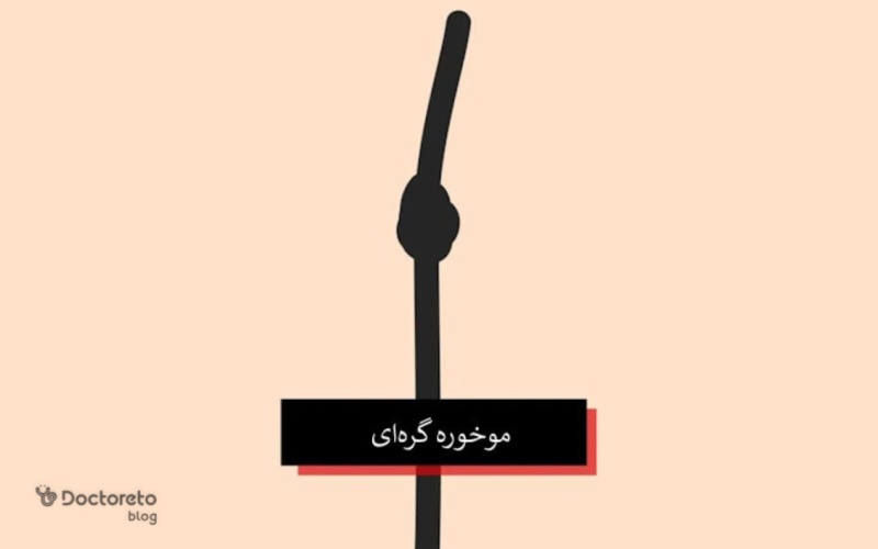 موخوره گره ای چیست؟