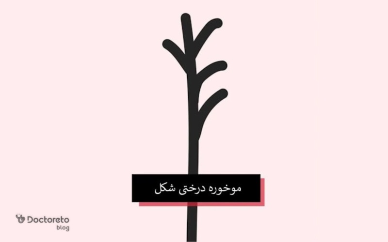 موخوره درختی چیست؟