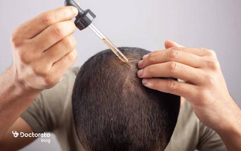 بهترین محلول رویش مو در جهان چیست؟
