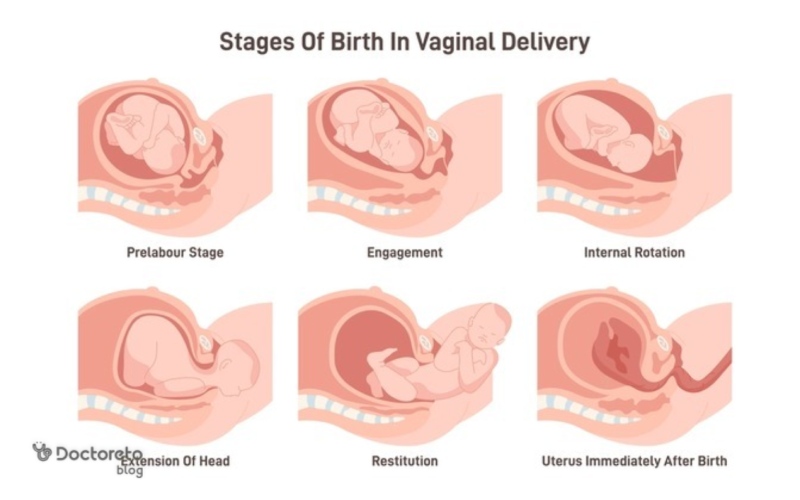 عکس زایمان طبیعی از نزدیک