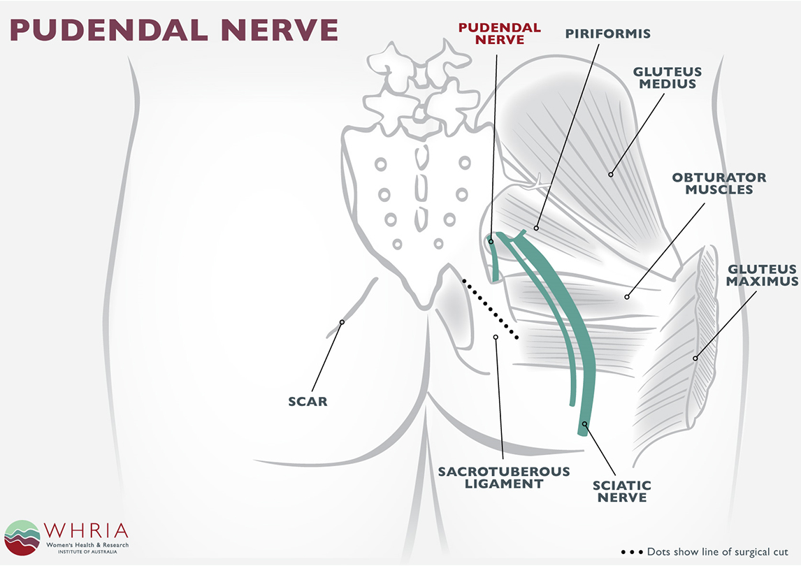 pudendal nerve and vaginal pain