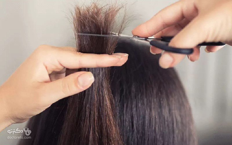 درمان موخوره بدون کوتاه کردن مو