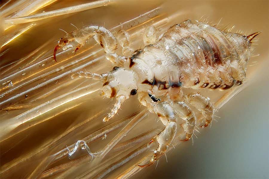Photo-of-head-lice