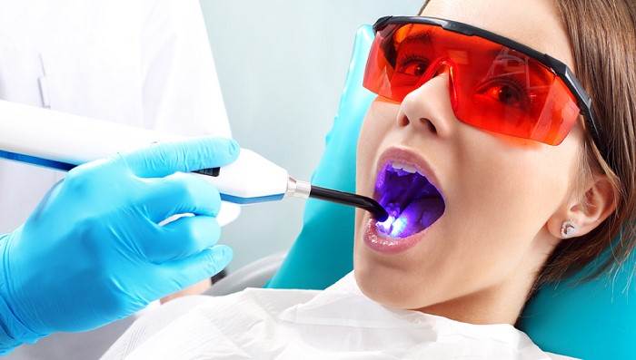 یکی از روش های جراحی دندان عقل با لیزر است