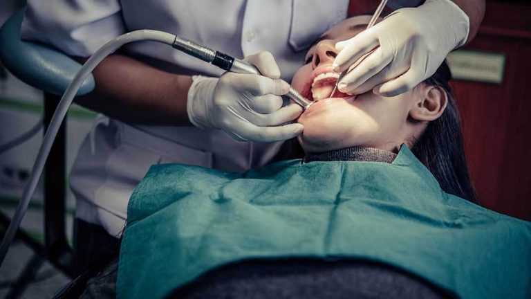 dental filling
