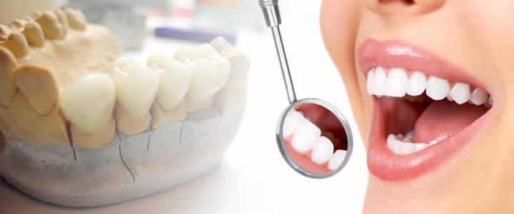 dental prostheses BENEFITS