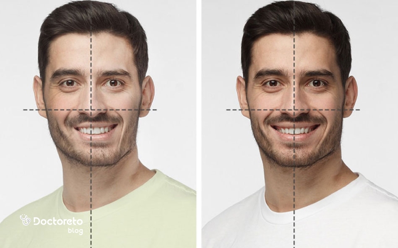 روش انجام جراحی فک چگونه است؟